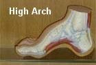 High arches