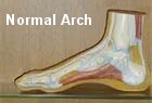 Normal arches