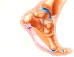 Heel pain diagram