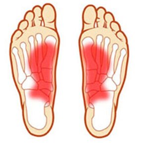 Painful feet caused by foot problems