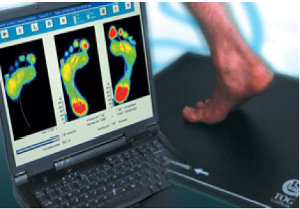 Foot analysis