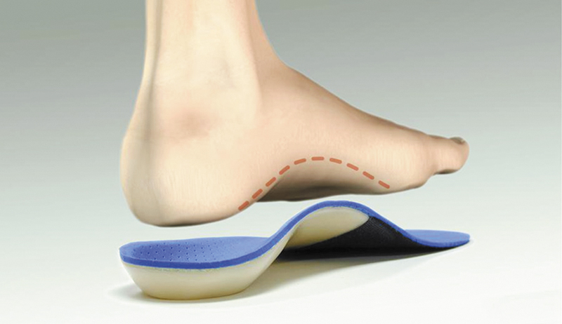 Ease your foot problems with custom orthotics