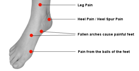 Problems areas on the foot