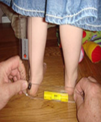Children's orthotic measurement